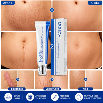 Crème Anti-vergetures & cicatrices – Retrouve une peau lisse et uniforme