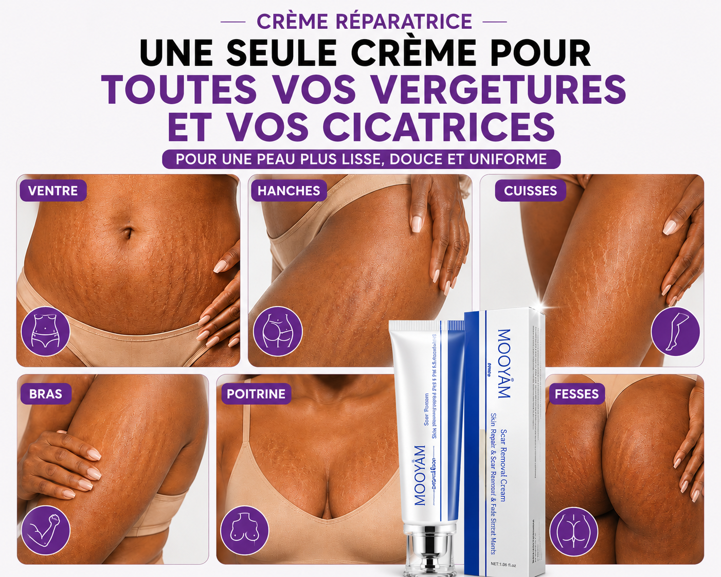 Crème Anti-vergetures & cicatrices – Retrouve une peau lisse et uniforme