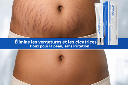 Crème Anti-vergetures & cicatrices – Retrouve une peau lisse et uniforme