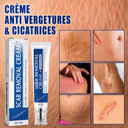 Crème Anti-vergetures & cicatrices – Retrouve une peau lisse et uniforme