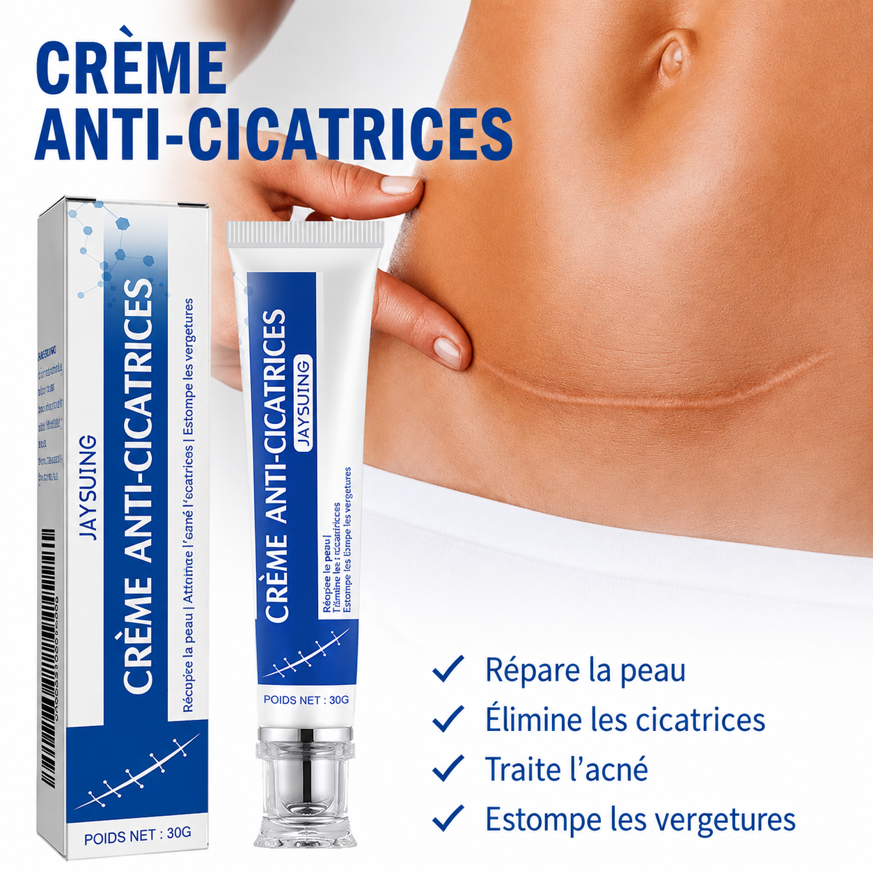 Crème Anti-vergetures & cicatrices – Retrouve une peau lisse et uniforme