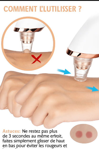 ASPIRATEUR DE POINTS NOIRS MULTIFONCTIONS